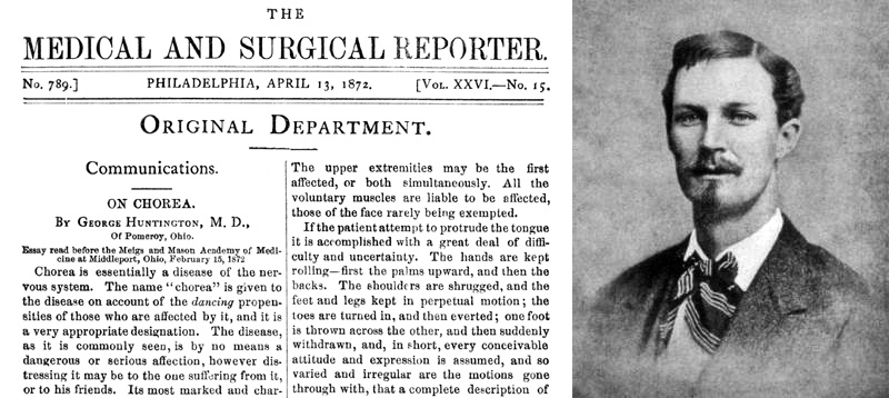 杭丁頓醫生在22歲發表了描述這個疾病的論文，此後以他的名字為此病命名。（圖／wikipedia）