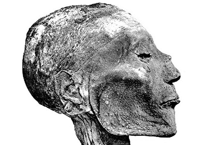 在西元前一千年的埃及法老王木乃伊的臉上可以看到得過天花的瘢痕。（圖／Wikipedia）