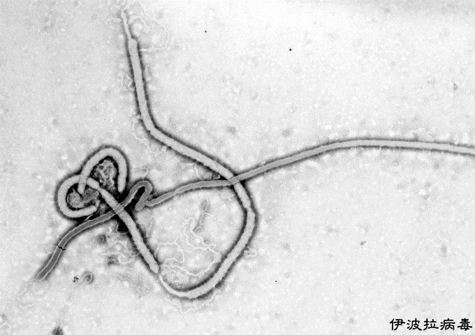 電子顯微鏡下的伊波拉病毒顆粒。（圖／Wikipedia）