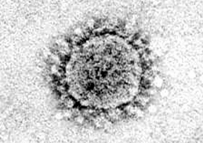 SARS病毒的電子顯微鏡影像很像一頂皇冠，所以稱它冠狀病毒。（圖／A novel coronavirus associated with severe acute respiratory syndrome，http://content.nejm.org/cgi/reprint/348/20/1953.pdf）