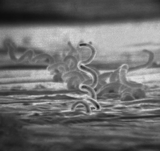 梅毒螺旋體的電子顯微照片。（圖／Wikipedia）