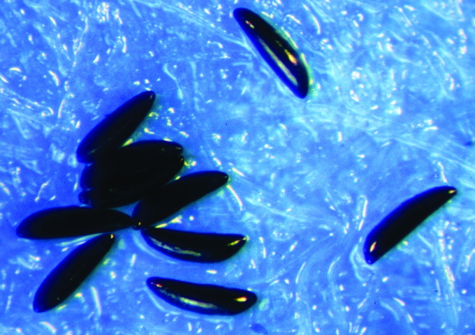 小黑蚊卵約僅0.3毫米，呈長橢圓形，一側微彎。