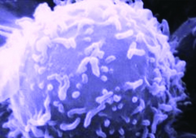 電子顯微鏡下的淋巴細胞，它是人體免疫系統的主要組成。