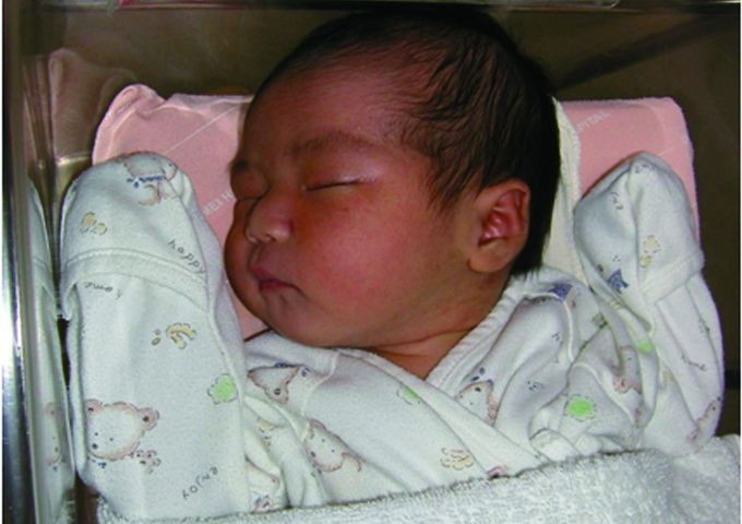 對於體溫調節中樞尚未完善的新生兒，棕色脂肪組織粒線體的產熱素，是維持體溫恆定不可或缺的因子。