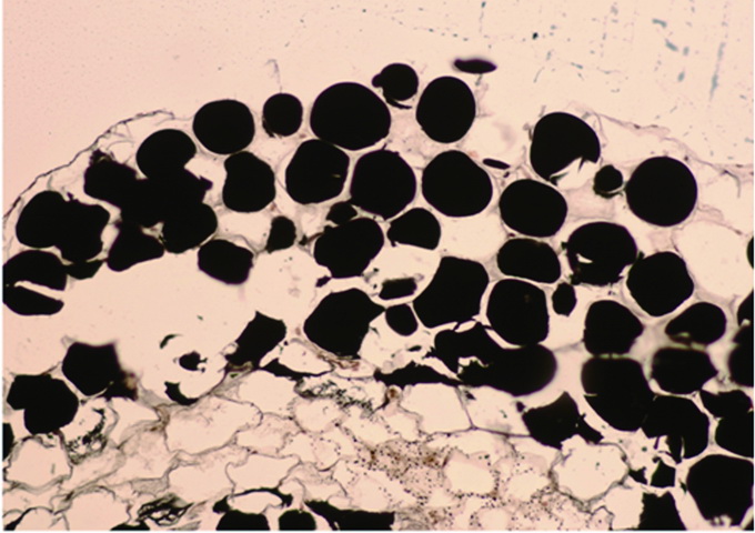 把脂肪染成黑色的結果顯示，白色脂肪細胞的細胞質有很多大型脂肪滴存在。（圖／謝佳洳提供）