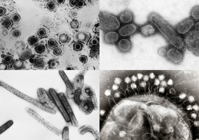 左上起順時針依序為：皰疹病毒、西班牙流感病毒、噬菌體、馬爾堡病毒。（圖／Wikipedia）
