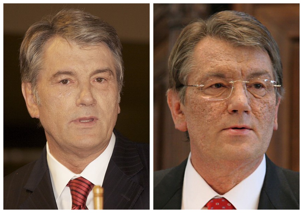 烏克蘭前總統尤希成科中毒前（左）和中毒且經治療後（右）（圖／（左）Jürg Vollmer，（右）Jonas Steinhöfel，wikipedia）