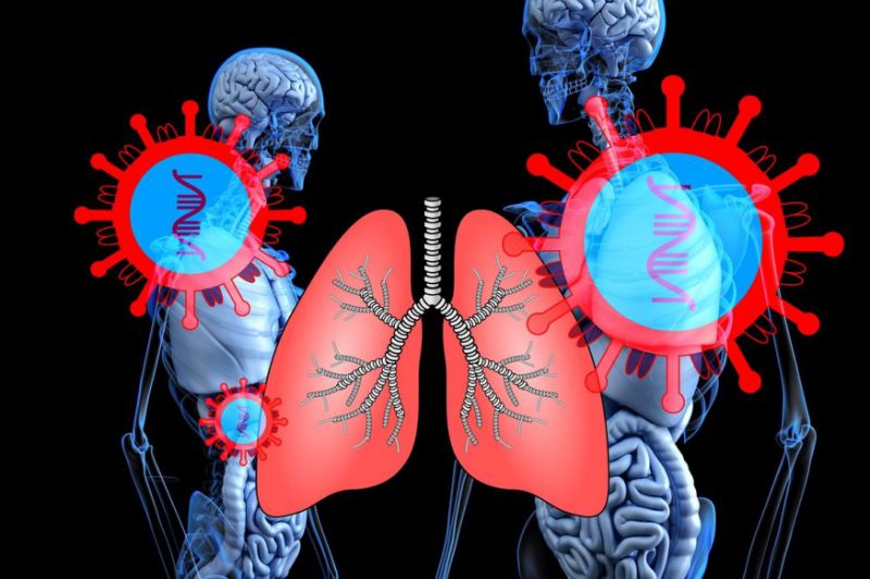 根據病理學的觀察，新流感的重症病例往往是病毒深入肺臟導致的。（圖 / Pixabay）