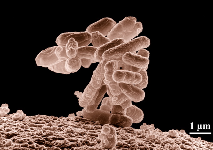 放大10,000倍的大腸桿菌（E. coli）菌叢