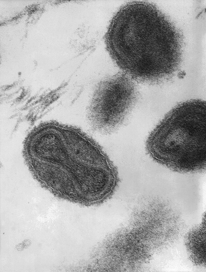 天花（small pox）病毒照片。（ 圖 /  Wikimedia，CDC，Dr. Fred Murphy ; Sylvia Whitfield）