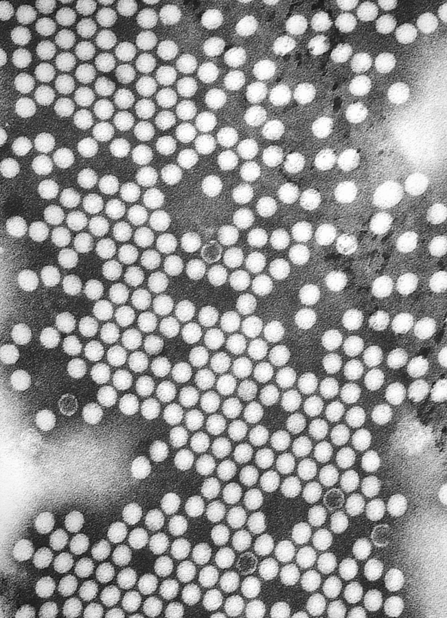 脊髓灰質炎（polio，俗稱小兒麻痺）病毒照片。（圖 /  Wikimedia，CDC， Dr. Fred Murphy ;  Sylvia Whitfield）