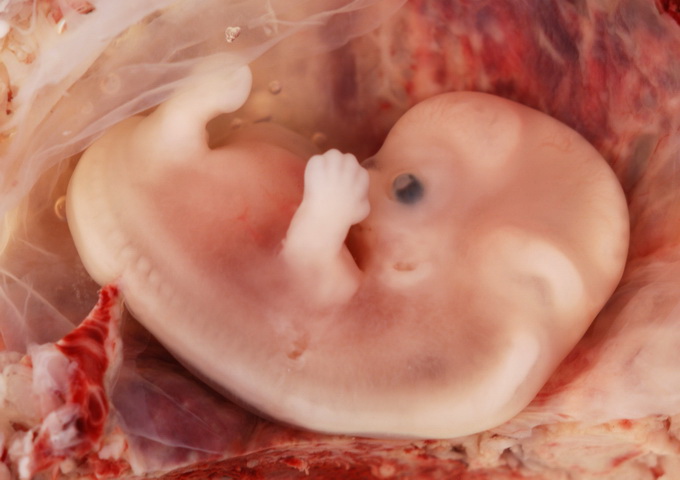 懷孕九週大的人類胎兒