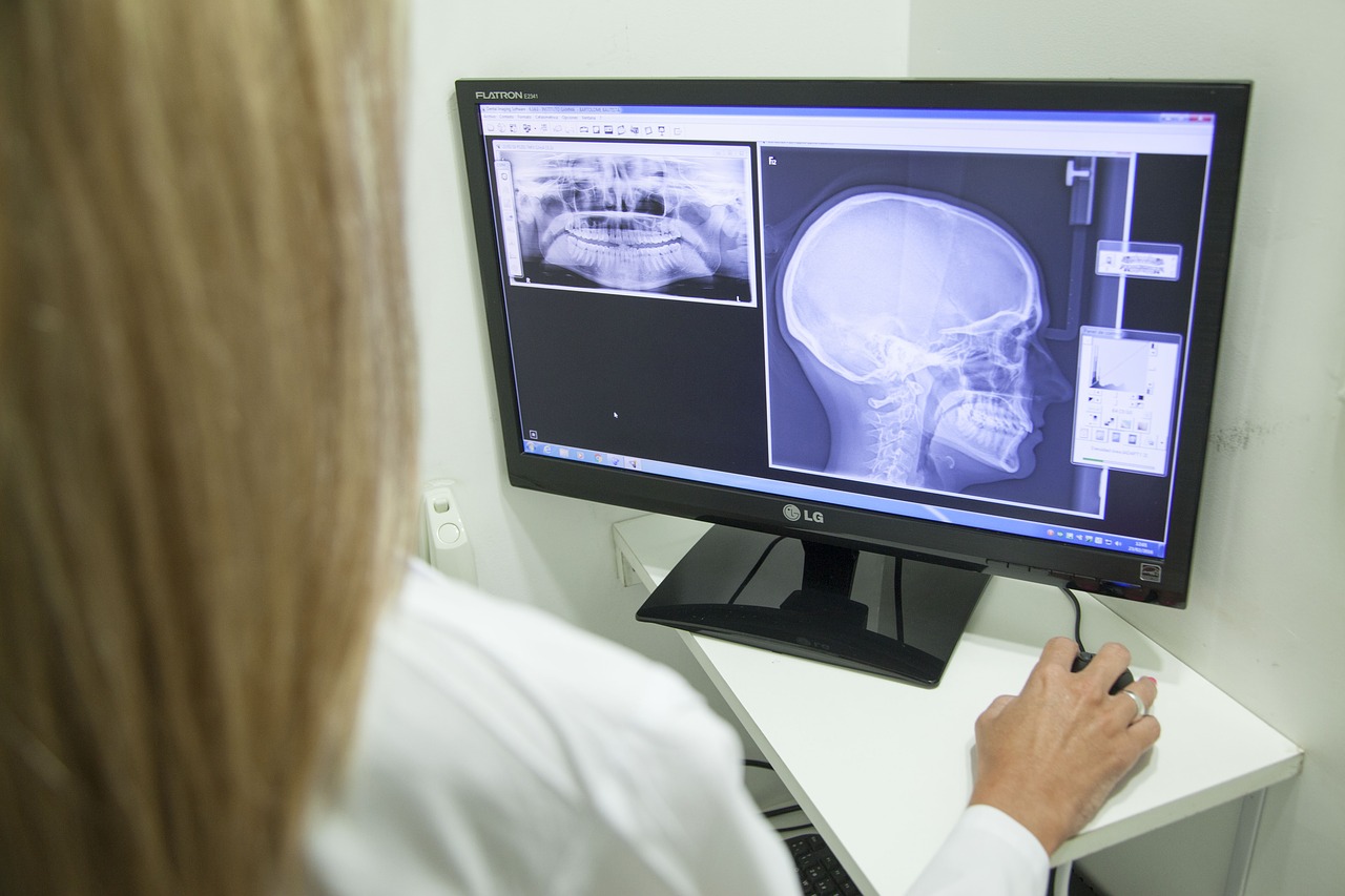 醫療人員正在觀察拍攝出的X光頭骨照片。（圖 / Pixabay）