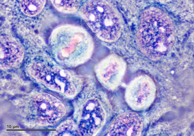 培養皿中正在細胞分裂的HeLa細胞（圖／Doc. RNDr. Josef Reischig，wikipedia）