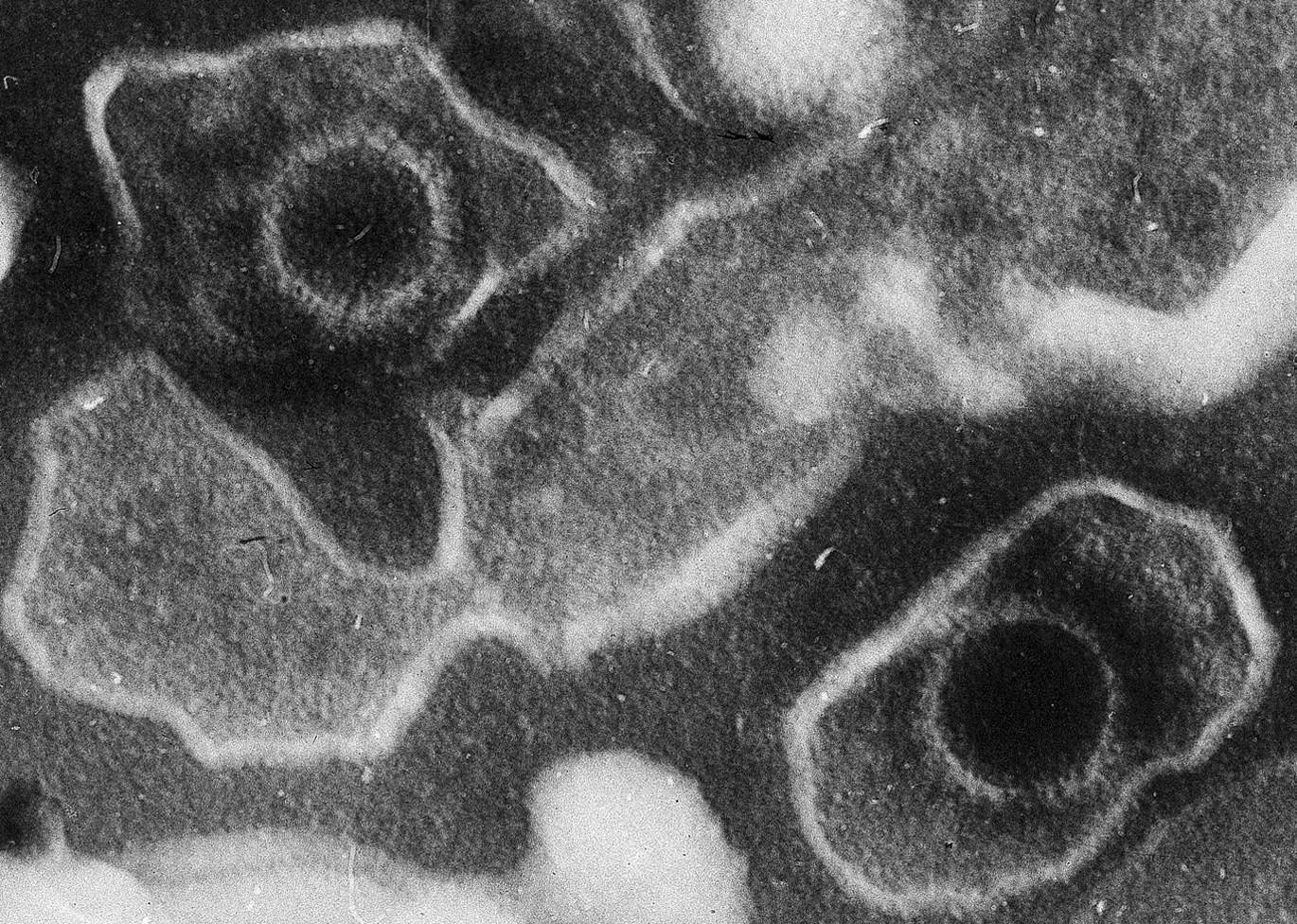 電子顯微鏡底下的EB病毒顆粒。張教授鑽研於EB病毒和鼻咽癌之間的關係長達數十年。（圖／Wikimedia）