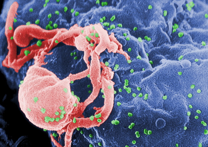 掃描電子顯微鏡下的HIV（綠色）出芽。（圖 / CDC/ C. Goldsmith, P. Feorino, E. L. Palmer, W. R. McManus，Wikimedia Commons，https://en.wikipedia.org/wiki/File:HIV-budding-Color.jpg）