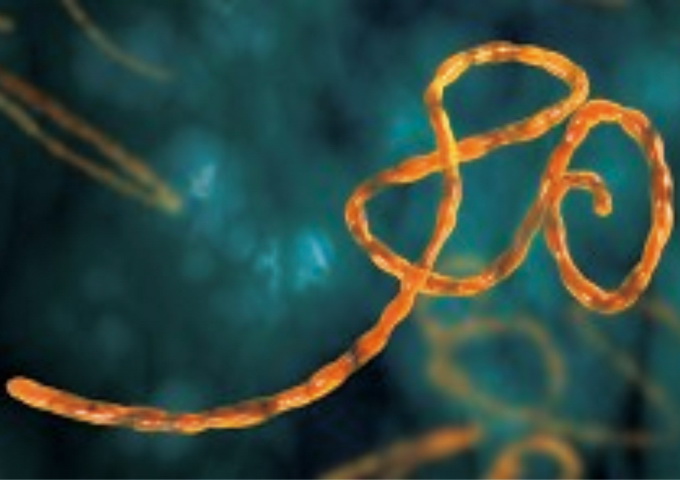 伊波拉病毒在電子顯微鏡下呈絲狀（圖片來源：http://www.modernmedicine.com/tag/ebola-virus）