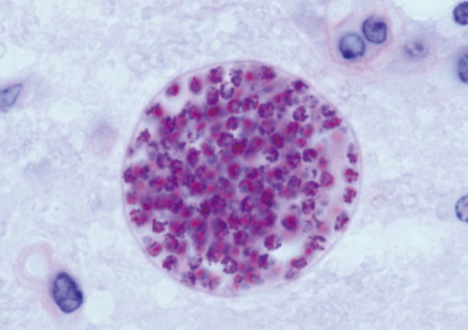 小鼠腦中的弓蟲囊胞，其中包含大量緩殖體（bradyzoites），它們在貓科動物的小腸裡才會分化成雌、雄配子。