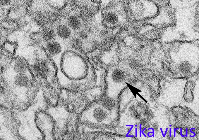 電子顯微鏡下的茲卡病毒。（圖／Cynthia Goldsmith，CDC，https://phil.cdc.gov/details.aspx?pid=20487）