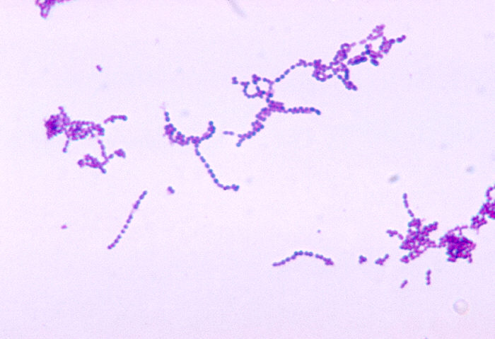 豬鏈球菌。圖片來源：CDC PHIL
