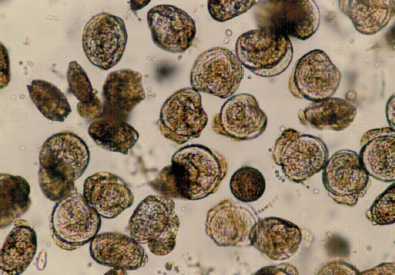 文蛤受精卵發育到D型浮游幼生後開始攝食微細藻