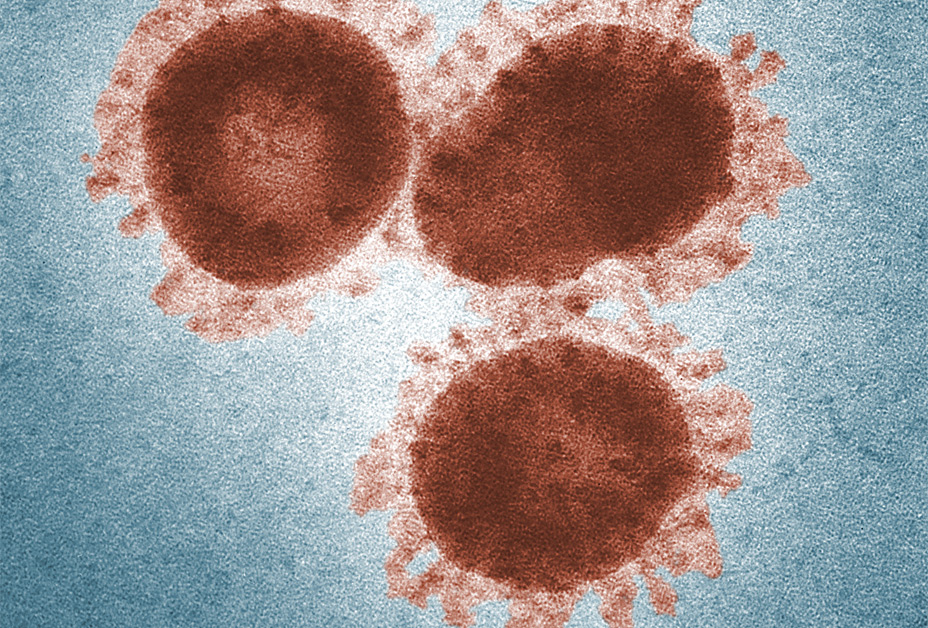 在顯微鏡下的SARS冠狀病毒顆粒（圖／美國疾病控制與預防中心，https://www.cdc.gov/dotw/sars/index.html）