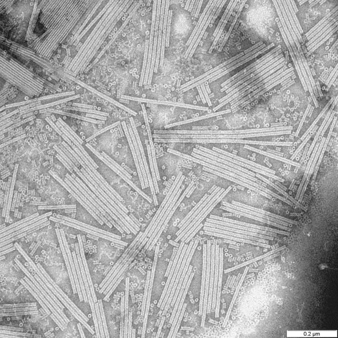 菸草鑲嵌病毒之電子顯微鏡照片。（圖／Wikipedia)