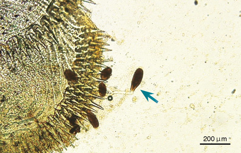 取病魚鱗片進行溼壓片檢查可見到鐘形蟲（綠色箭頭）。