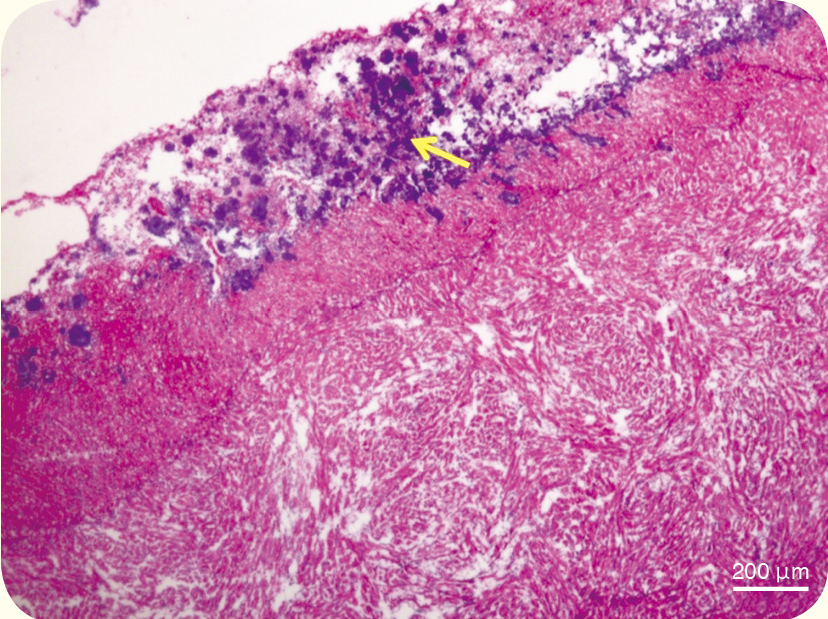 鏈球菌感染的魚心臟經組織病理切片檢查，呈現心包膜炎，間皮組織增生並可見細菌團塊（黃色箭頭）在其中。