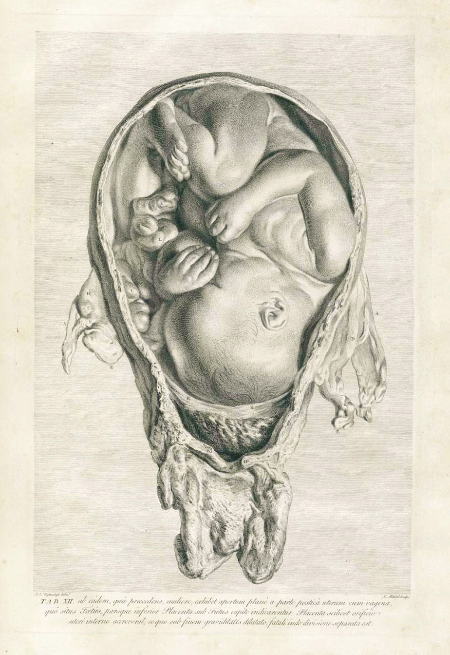 英國18世紀的婦產科醫師威廉･杭特爾請畫家畫的有關婦產科的精緻解剖圖。（圖／https://en.wikipedia.org/wiki/William_Hunter_(anatomist)?fbclid=IwAR3DzO68z0k3_j1fxVWqrAvC4RkQN3RtT5PgrybBUD6Ja_tZtYXWhdHJrsw#/media/File:Hunterw_table_12.jpg）