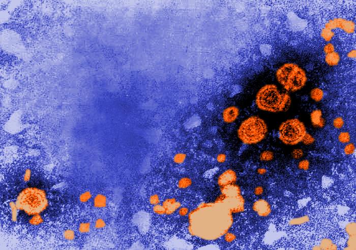 B型肝炎病毒。（圖／Microbe World，Flickr）
