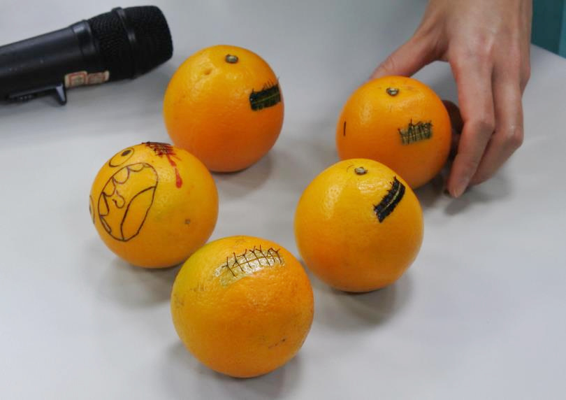 「橘子」病患的手術成果。