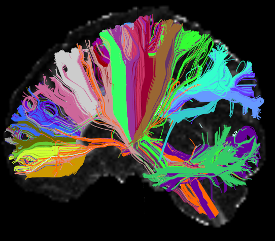 人類腦神經細胞磁振造影(高角解析度擴散影像)。（圖／ NIH Image Gallery）