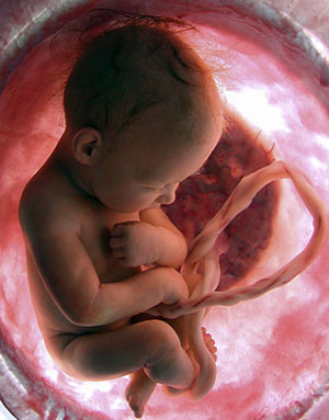 英國劍橋大學一個團隊檢驗了537名婦女的胎盤，發現健康孕婦的胎盤裡沒有細菌。因此，胎盤不會是新生兒腸道菌群的來源。（圖片來源：jorge junior，Flickr）