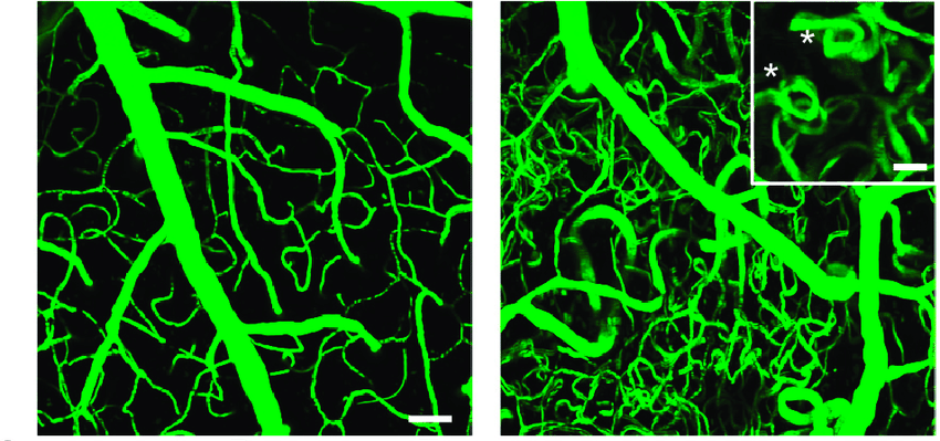通過光子顯微鏡拍攝之老鼠血管。左圖為正常血管，右圖為扭曲血管。（圖／美國國家科學院院刊2018年115期）