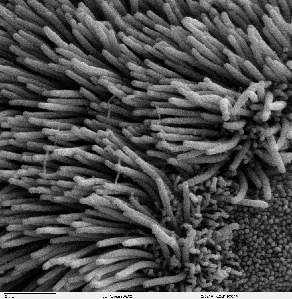 氣管表面的纖毛，由電子顯微鏡拍攝。（圖／Louisa Howard，wikimedia）