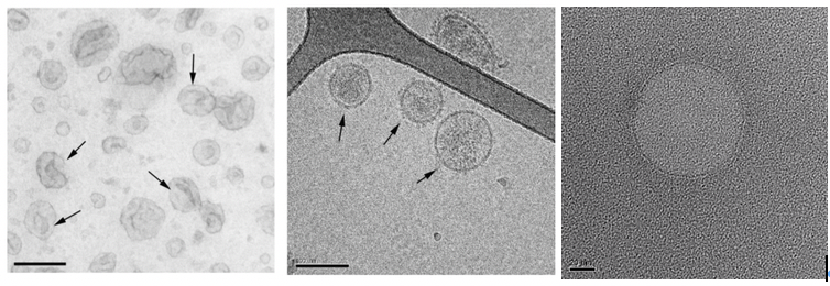 乾式（左）、冷凍（中）、液體（右）處理的胞外體在電子顯微鏡下的型態。左圖與中圖為黑色素瘤細胞所分泌的胞外，右圖則是人類臍靜脈內皮細胞所分泌的胞外體。（圖／吳佳慶提供，資料來源：Raposo, G., and Stoorvogel, W. Extracellular vesicles: exosomes, microvesicles, and friends. J Cell Biol 200, 373-383, 2013.）
