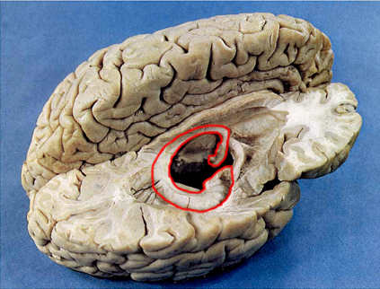 海馬迴在大腦皮質下方，是大腦邊緣系統的一部分，負責人類的空間定位以及記憶能力。（圖／Duke University School of Medicine）