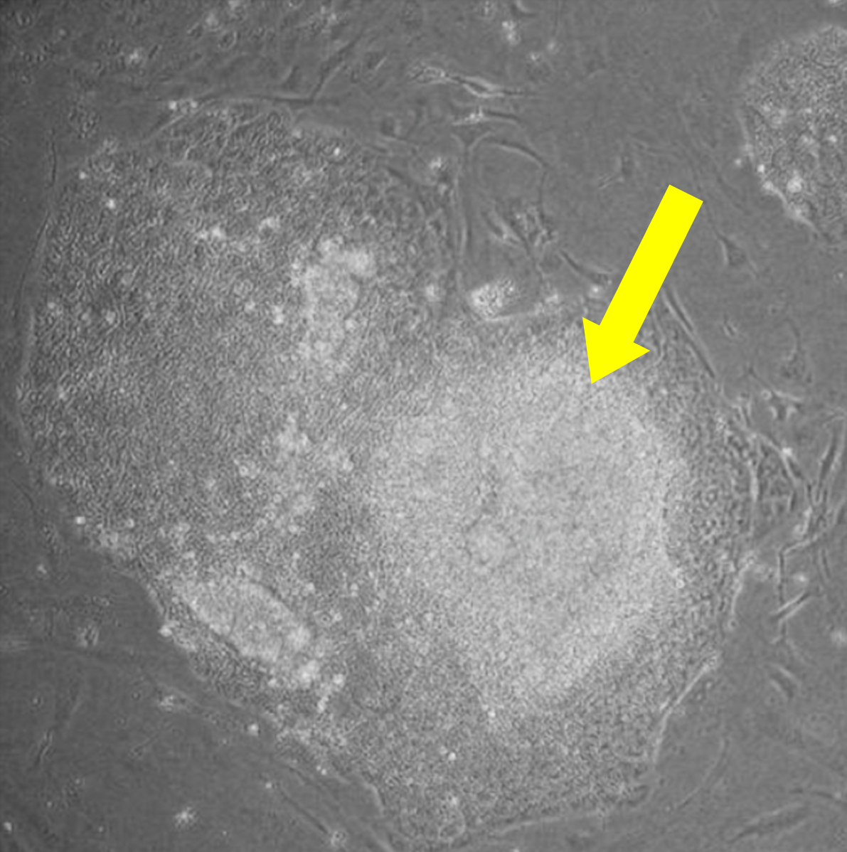 人類iPS細胞（黃色箭頭處）。（圖／Christine Hale等人，Induced Pluripotent Stem Cell Derived Macrophages as a Cellular System to Study Salmonella and Other Pathogens. PLOS ONE., 2015）