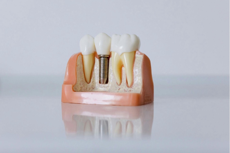 齒槽骨的功用是支撐與保護牙齒，就像房子的地基