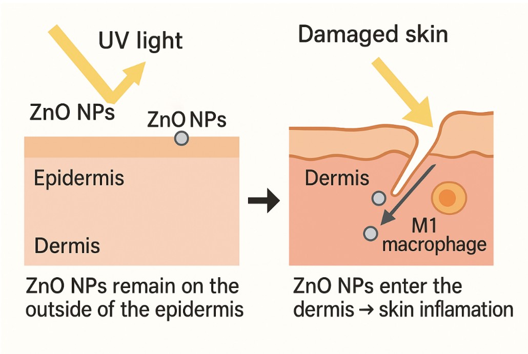 米氧化鋅（ZnO NPs）在健康皮膚中僅停留於表皮，但若皮膚因紫外線受損，奈米粒子就可能穿透進入真皮層，刺激免疫細胞，進而引發發炎反應