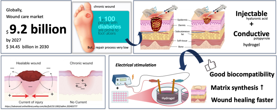慢性傷口,如糖尿病足部潰瘍的癒合慢,因為患者體內促進組織修復的微電流極弱(左下),治療往往需要消耗大量醫療資源(左上)。可注射式玻尿酸–聚吡咯水膠能填滿不規則傷口,玻尿酸保水柔軟,聚吡咯產生微弱電場,幫助細胞移動與組織修復(右上與右下)。