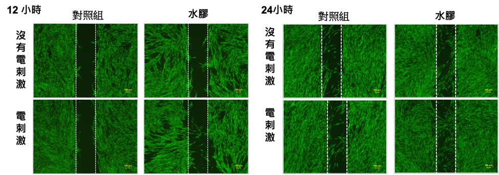 細胞刮除後水膠覆蓋下的傷口癒合情況。人類真皮纖維母細胞(Human Dermal Fibroblasts, HDF)經刮除形成缺口後,於水膠覆蓋條件下,觀察沒有電刺激(上排)與電刺激(下排)處理後的細胞遷移情形。左欄為電刺激後 12 小時影像,右欄為 24 小時影像。綠色螢光為活細胞,虛線標示初始刮痕邊界。可以見到電刺激促進細胞向缺口中心遷移,水膠結合電刺激更有助於傷口修復。