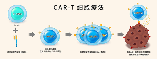 CAR-T細胞療法先取出患者T細胞，經基因工程改造與培養後，再輸回體內，協助免疫系統辨識並攻擊癌細胞。(圖片提供：Shutterstock)