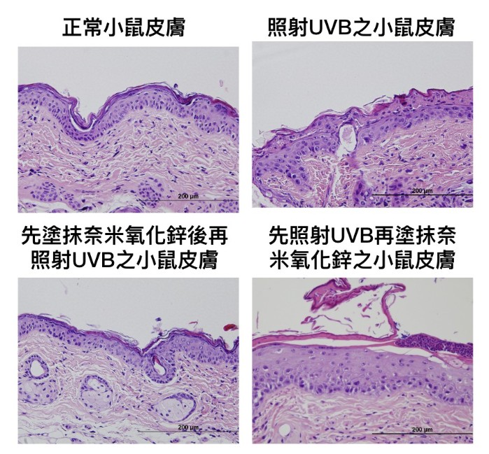 「防曬神隊友」變「皮膚殺手」？揭開奈米氧化鋅的雙面謎團  